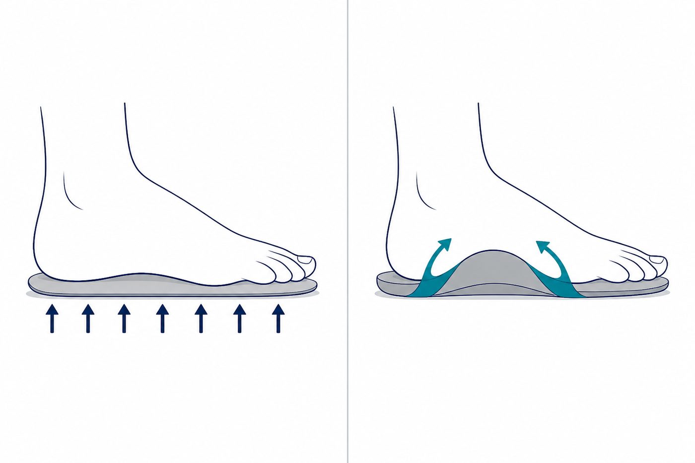 Insole versus banding